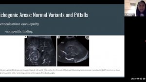 Нейросонография новорожденных