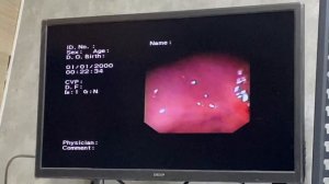 Биопсия желудка: ключ к точной диагностике 🔍🔬