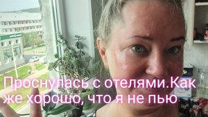 Проснулась вся в отеках/как же хорошо, что я не пью