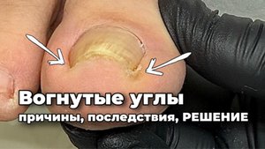 Монолит боковой стенки дал сбой