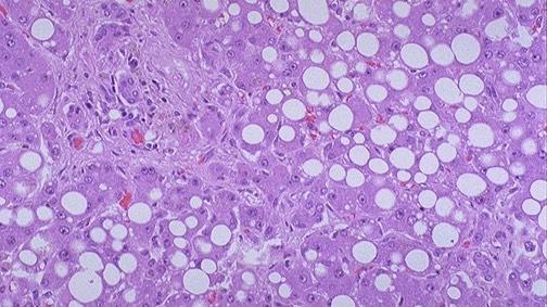 Дистрофии 2 части