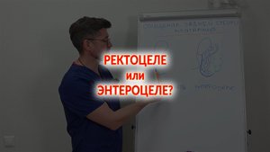 Опущение влагалища. Ректоцеле или энтероцеле?