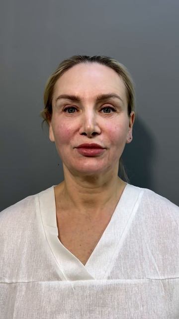 Комплексное омоложение лица, до и после пластической операции смотреть онлайн