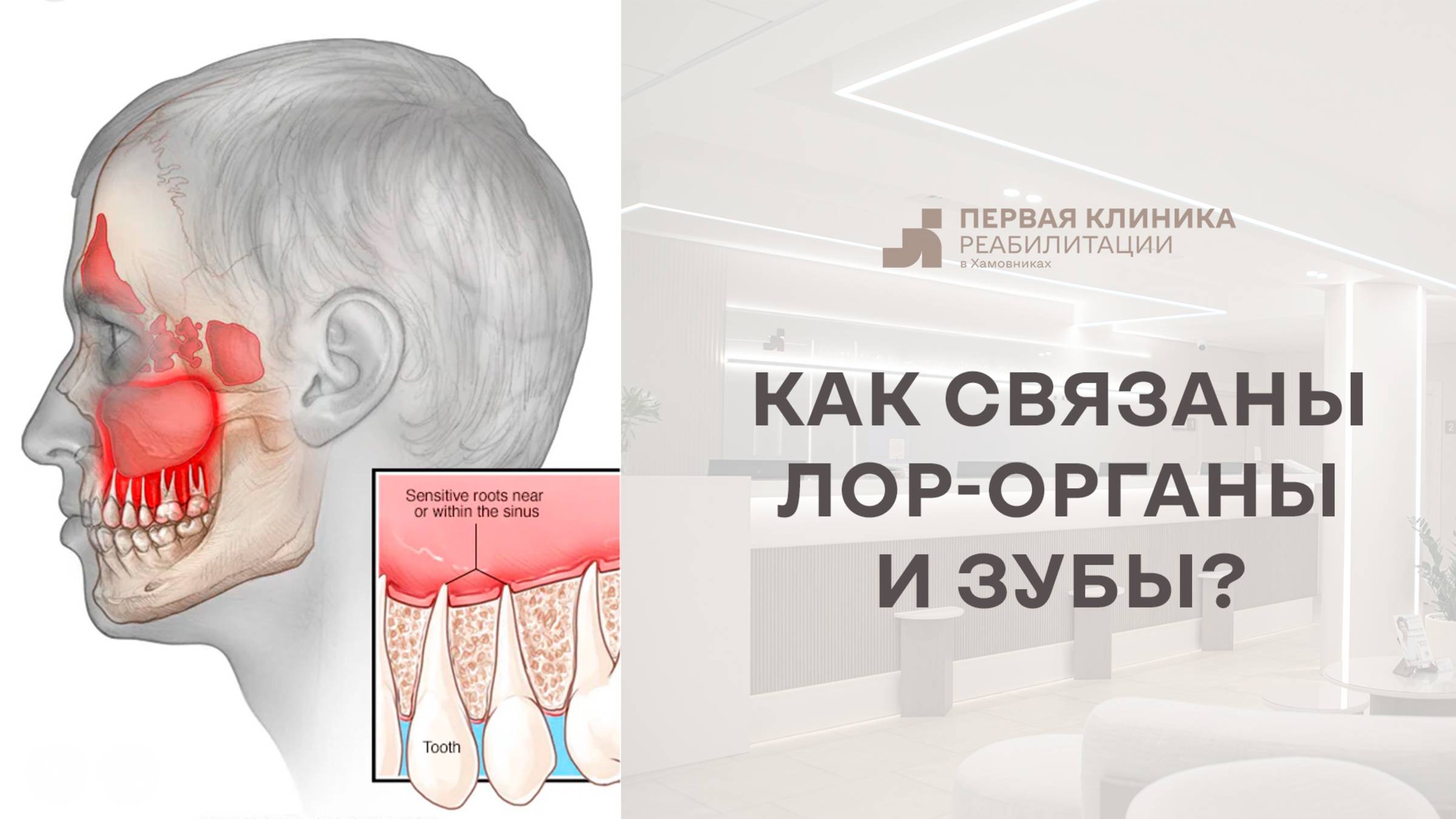 Частота встречаемости синусита