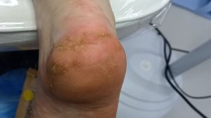 Эх пяточки
 https://vk.com/podolog_svetlana_pz