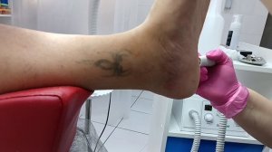 Педикюр для мужчины