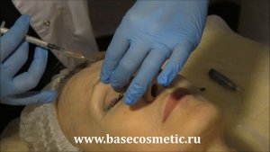 Инъекционные методики. Введение ботулотоксина. Учебный центр Base