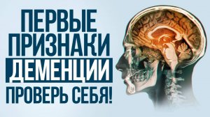 Больные ДЕМЕНЦИЕЙ начинают делать ЭТО в первую очередь! Как улучшить работу мозга БЕЗ ЛЕКАРСТВ?