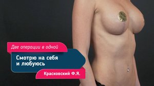 Липоскульптура и повторная маммопластика | Коррекция груди и бёдер у Красковского Фёдора Яновича