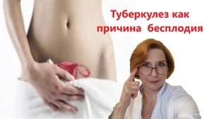 Туберкулез как причина бесплодия