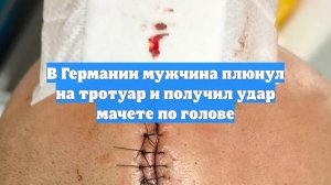 В Германии мужчина плюнул на тротуар и получил удар мачете по голове