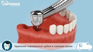 Длятвокончательный