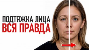 Самая БЫСТРАЯ и БЕЗОПАСНАЯ подтяжка лица! / Кому и в КАКОМ возрасте лучше делать ЭТУ операцию?