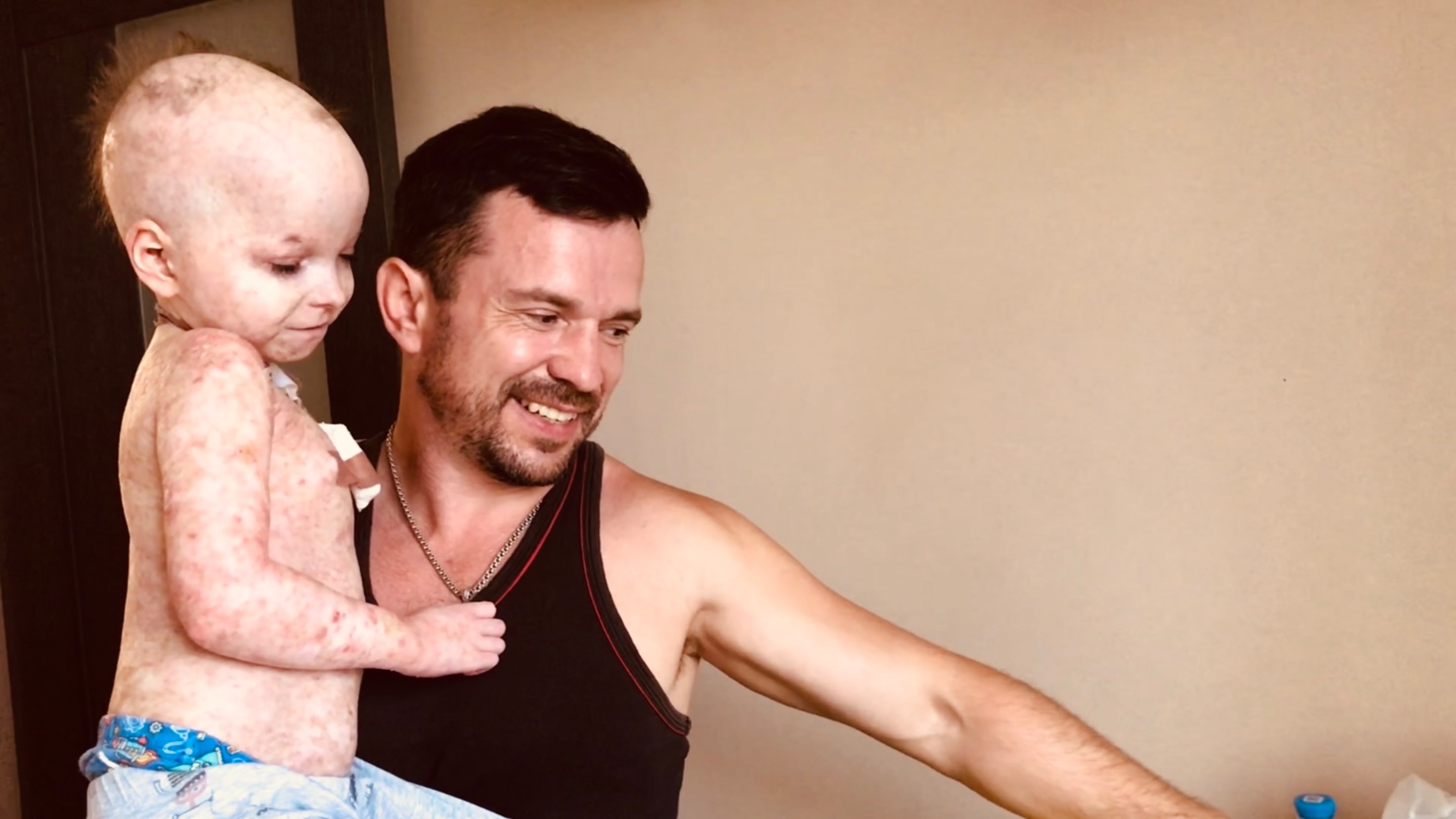 Лечение сына / Сюрприз от подписчицы / Маркуша от нас прячется / Жизнь смотреть онлайн