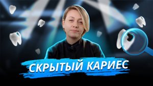 Скрытый кариес. Как узнать врага зубов до боли?