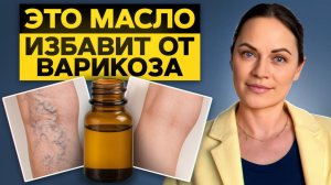 ИЗБАВЛЯЕМСЯ от варикоза БЕЗ ВРАЧЕЙ и УКОЛОВ! / Как вылечить вены с помощью эфирных масел?