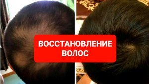 КАК ВОССТАНОВИТЬ ВОЛОСЫ
