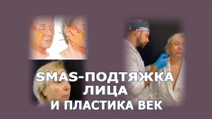 Фейслифтинг и блефаропластика: лицо и шея за один наркоз