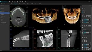 Meyer - 3D Panorama with Endo