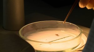 На Ставрополье уже зарегистрировали 14 случаев заражения крымской геморрагической лихорадкой