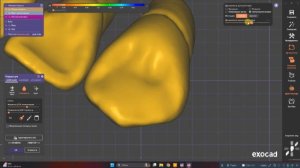 Окклюзия практика - Часть 3