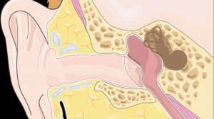 Слуховой нерв: как работает и что происходит при его повреждении? Всё о неврите и других патологиях