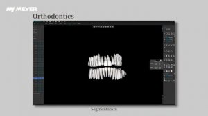 Meyer - The best Chinese CBCT brand, the most cost-effective choice