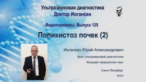 Ультразвуковая диагностика (УЗИ). Доктор Иогансен. Видеопримеры. Выпуск 125. Поликистоз почек (2).