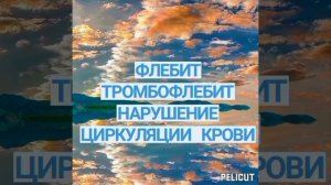 Лечение тромбофлебит