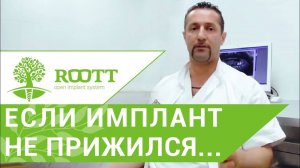 Зубной имплант. Что делать если, зубной имплант не приживается.  ROOTT