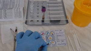 021. Предтрансфузионные тесты перед трансфузией эритроцитной взвеси. 10.12.2023 г.