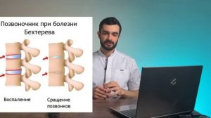 Как вылечить спину. Видео 2