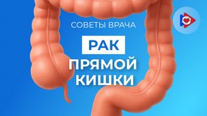 Про рак прямой кишки.