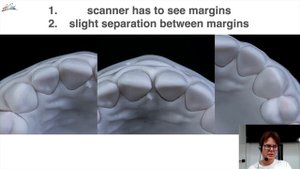 Современная керамика и «команда цифровой стоматологии».