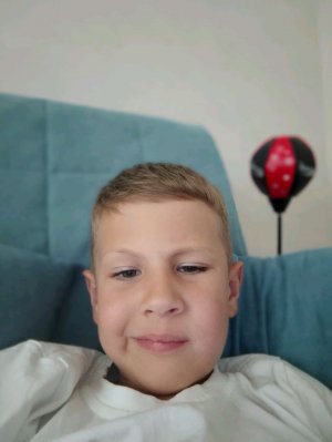 у меня шатается зуб 🦷