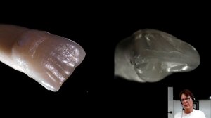 Корректор эмали и скульптор, создающий идеальную поверхность (цифровая стоматологическая команда)