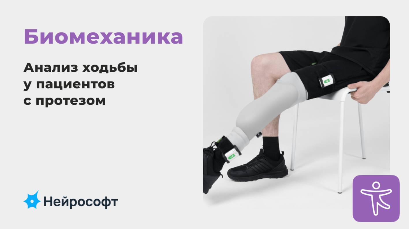 Биомеханика: анализ ходьбы у протезируемых пациентов