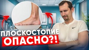 Что такое плоскостопие и возможно ли его вылечить? Полный гид!