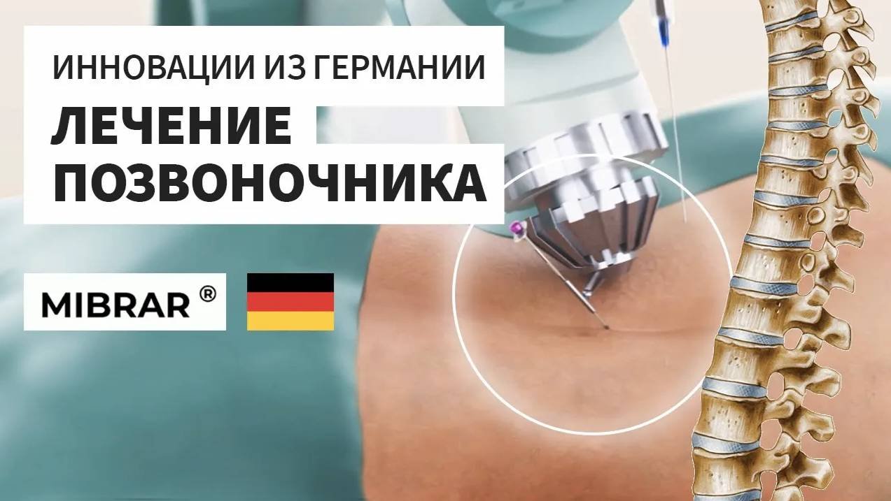 Методика лечения заболеваний позвоночника без операции из Германии #MIBRAR, #ЛечениеПозвоночника