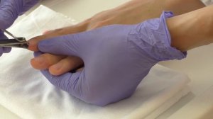 Уход за ногтями тяжелобольного пациента