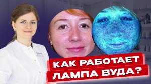 Что скрывает ваша кожа? Лампа Вуда: что важно знать