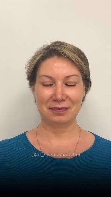 Периорбитопластика. Пластический хирург Светлана Божор периорбитопластика