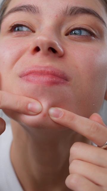 Новая серия Teenskin уже доступна для ВИП-консультантов! смотреть онлайн