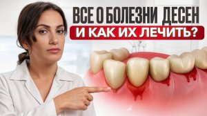 Каждый 5-й на планете болеет, а лечится НЕВЕРНО! Заболевания десен - вся правда от опытного врача