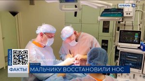 На восстановление лица покусанного хаски мальчика из Сочи потребуется пять лет