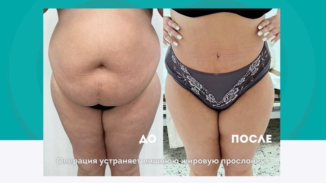 Пластическая хирургия в клинике МЕДСИ-Промедицина