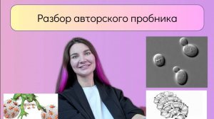 Белки-антифризы, нелегальное мясо китов, дуги аорты