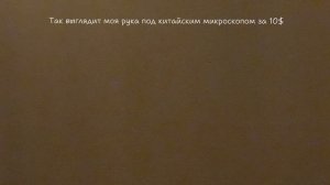 Так выглядит моя рука под китайским микроскопом за 10$