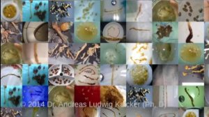 Андреас Калькер Аутизм субтитры на русском языке