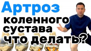 Что делать при артрозе коленного сустава?!